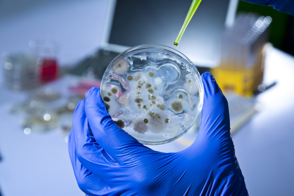 Why your Operation needs effective Microbiological Testing